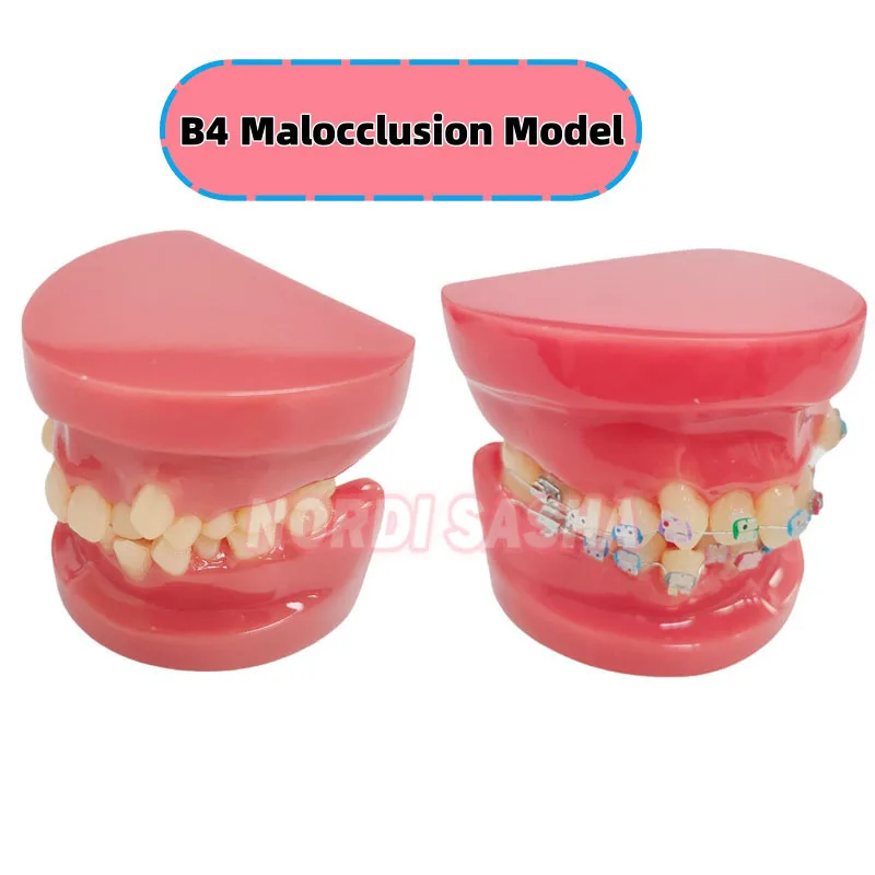 

1Pcs Dental Half-metal Half-ceramic Malocclusion Orthodontic Teeth Model Dental Typodont Crowded Teeth Orth Teaching Model