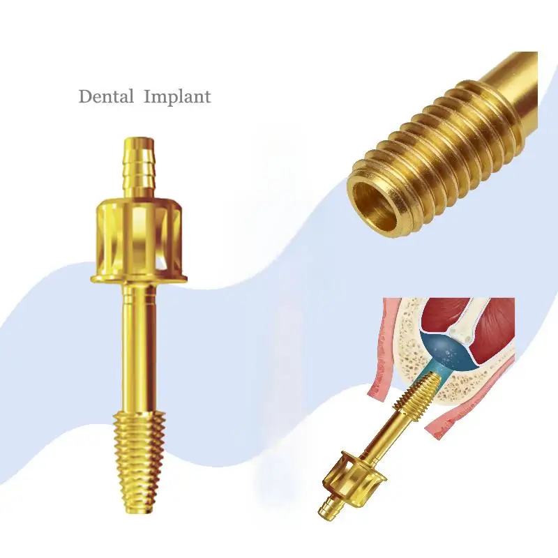 

Стоматологический гидравлический водонапорный мембранный лифтинг-инструмент для верхнечелюстного пазухового лифтинга Aqua Tip с герметичной трубкой и направляющим сверлом для поднятия пазух