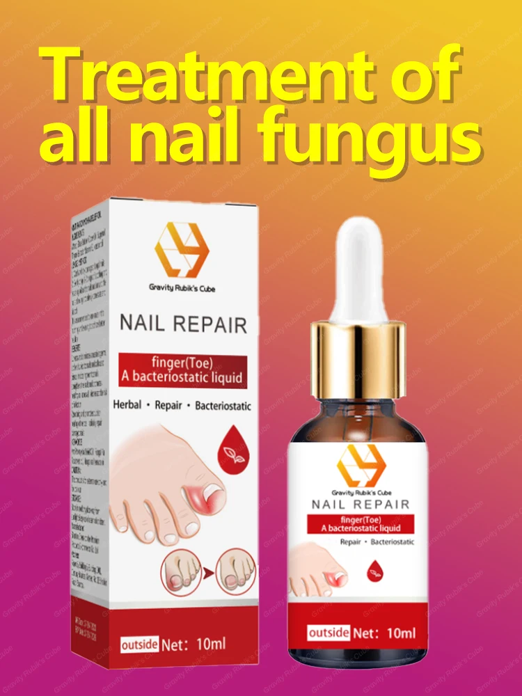 

Solve all nails problems