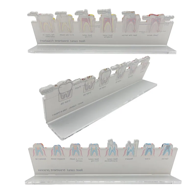 Dental Root Canal Treatment Flowchart Stand Endodontic Process Guide Dental Lab Study Teaching Demonstration Model Dentist Gift