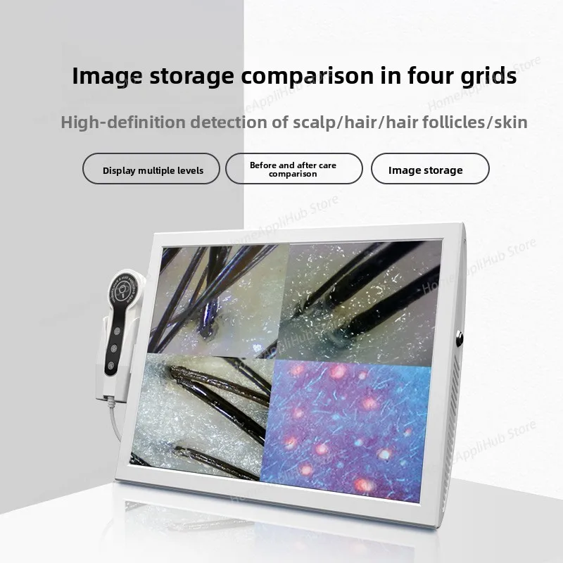 15 Inch HD Display Professional Hair Follicle Detector Scalp Diagnostic Machine Skin Analyzer Oil Moisture Skin Tester