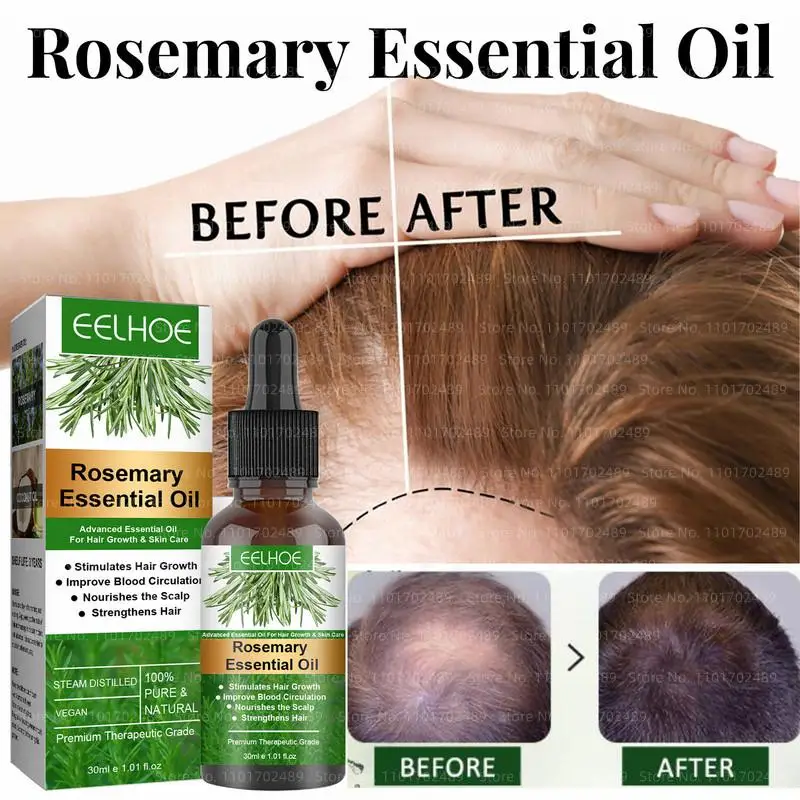 Rosemary Hair Care Essential Oils Organic Pure Natural Reduce Hair Loss Prevent Hair Breakage Hair Deep Nourish Scalp Growth Oil