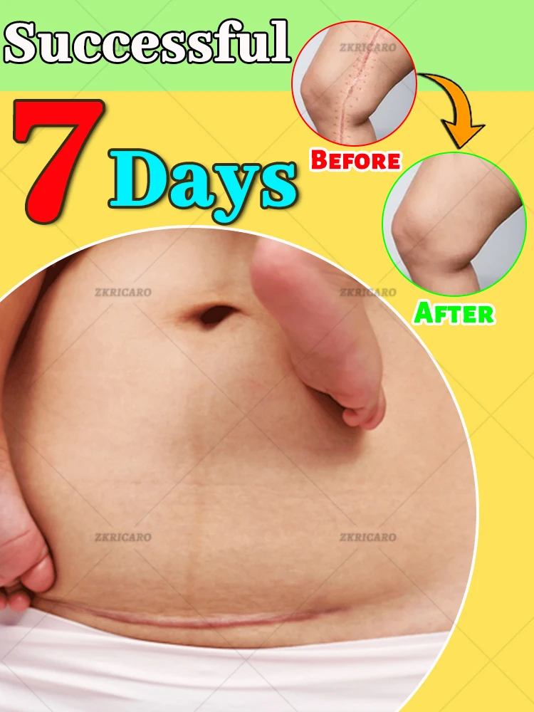 

Мишени различные шрамы и открытки быстрые результаты