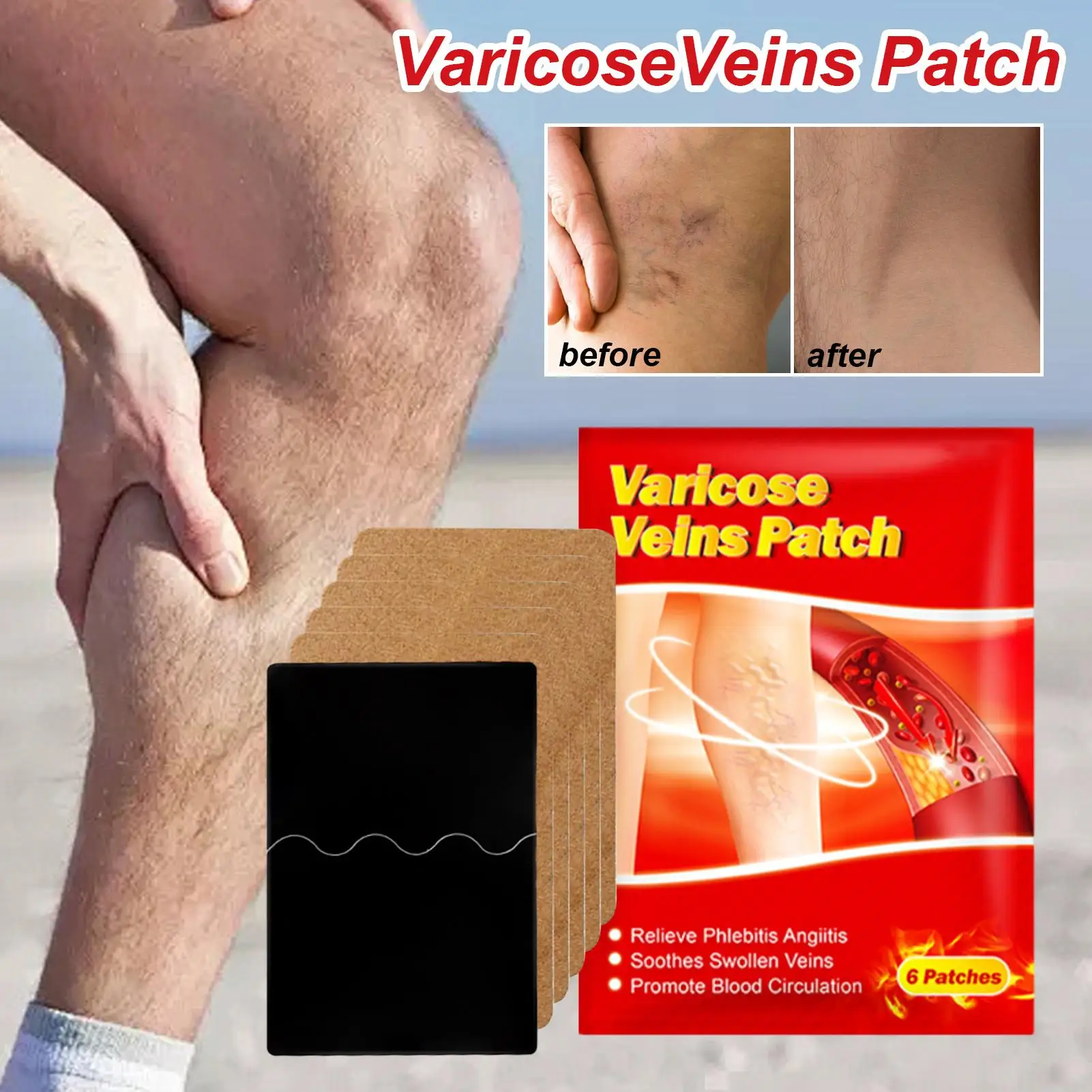 Patches für die Beinschwellung, 6-teiliges Patch zur Abdeckung von Besenadern, natürlicher, beruhigender Aufkleber, Concealer für Fußbeschwerden, Hautunterstützung