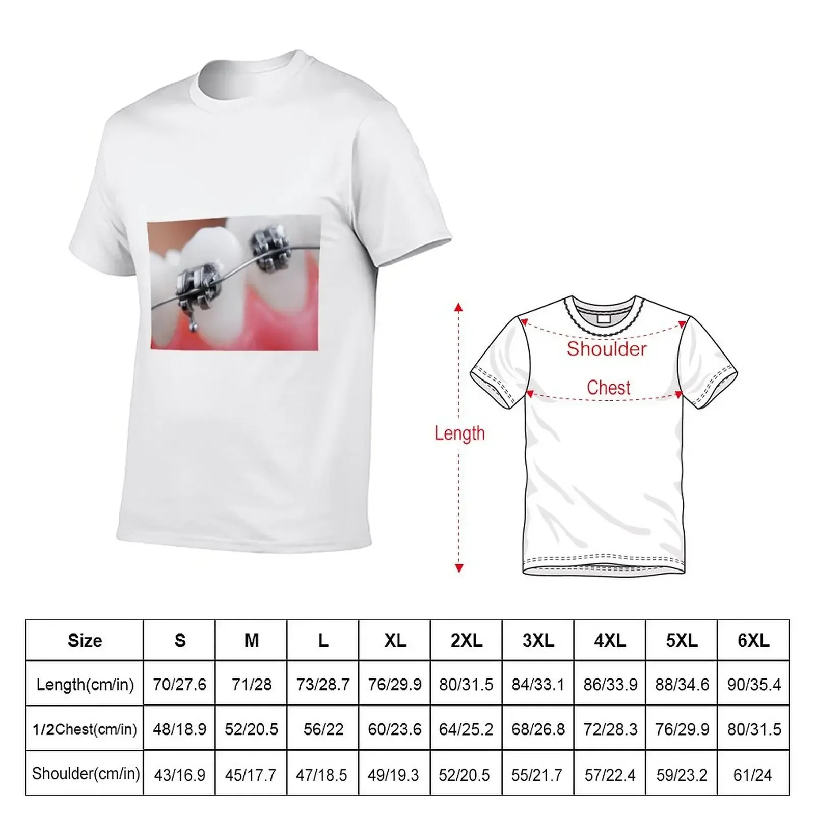 Dental braces T-Shirt kawaii clothes Blouse Men's t-shirt