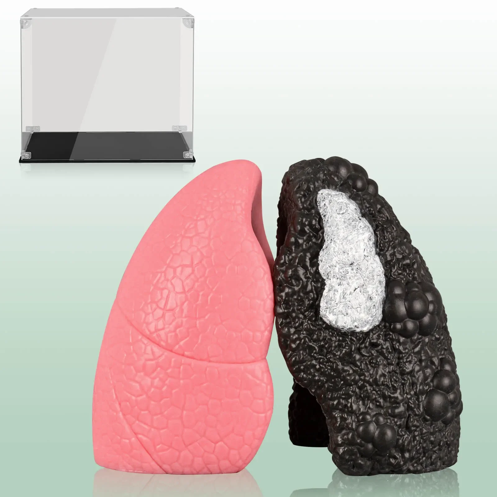 Ultrassist Healthy Lung vs. Smokers Lung Model Set