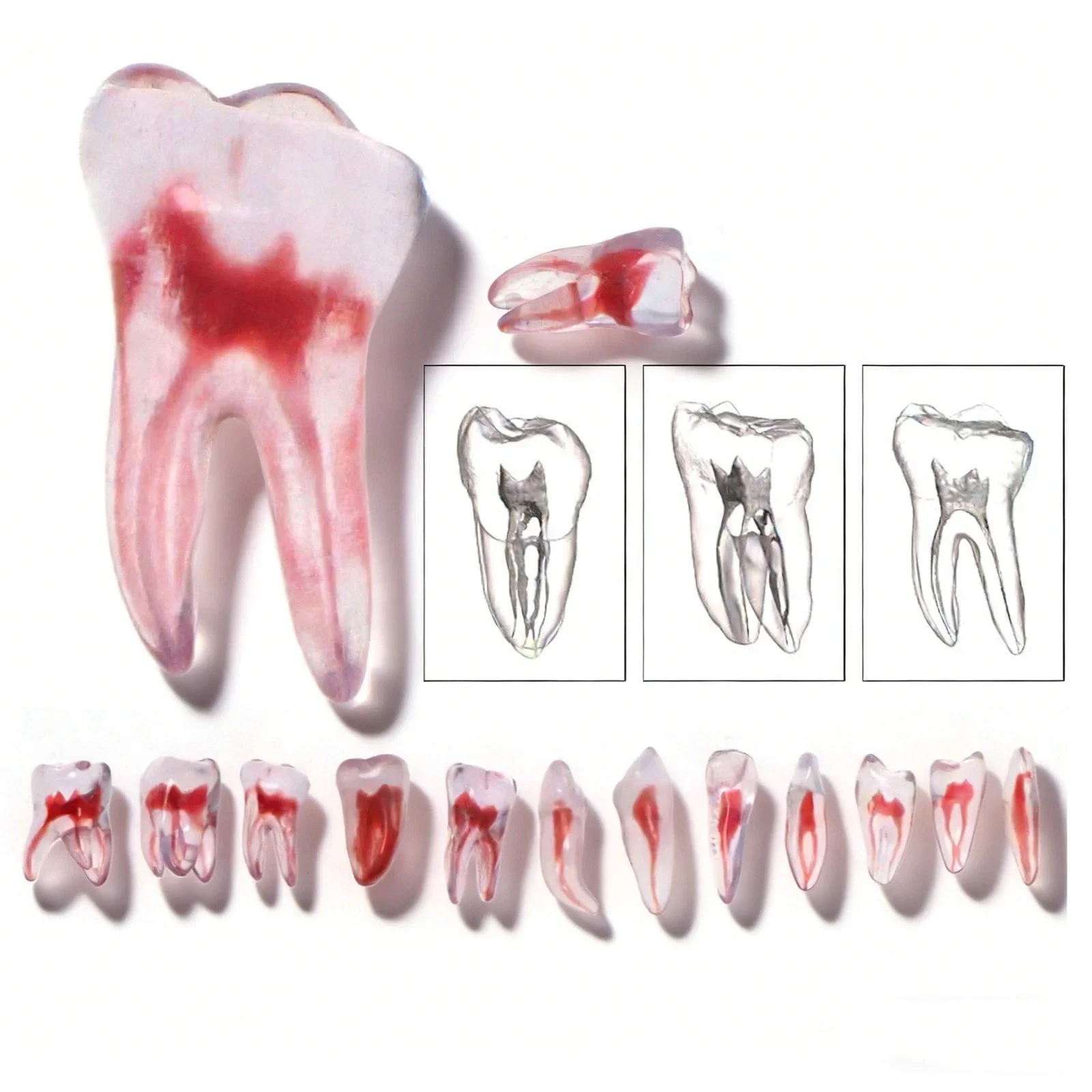 Dental Resin Root Canal Tooth Model Visible Root Canal Anatomy 3D Endo Training Teeth for Dentist Student Teaching Demo Tool