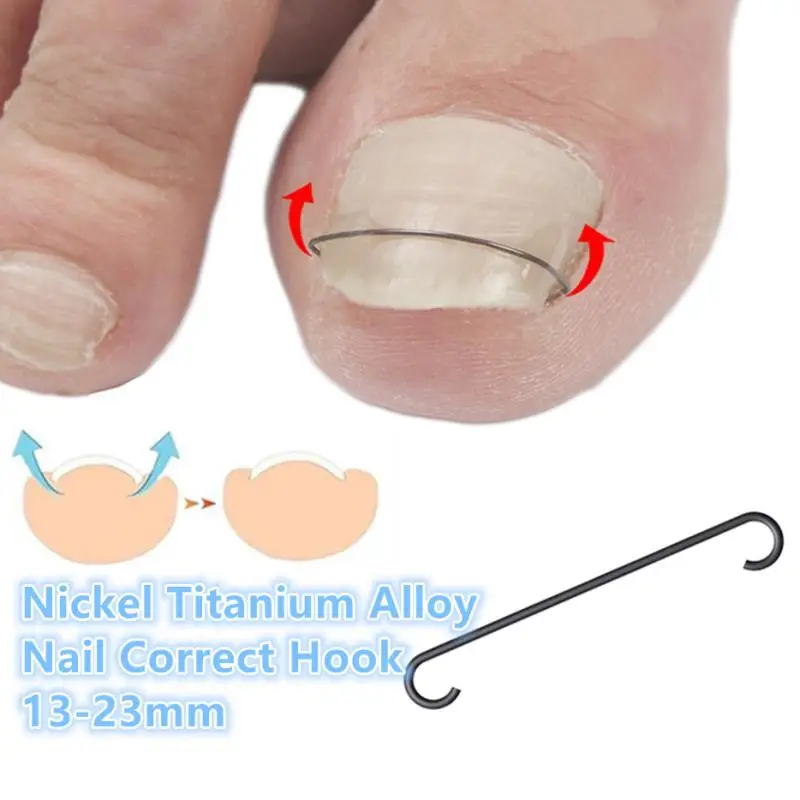 

【Ingrown Toenail Corrector Tools Pedicure Recover Embed Toe Nail Professional Ingrown Toenail Straightening Clip Brace】