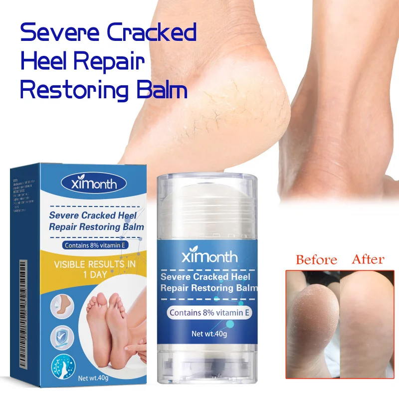 

Heel Repair Cream - 40g, Prevents Dry Cracks & Peeling, Hydrating Foot Care, Soothes Heels with Lavender & Mineral Oil