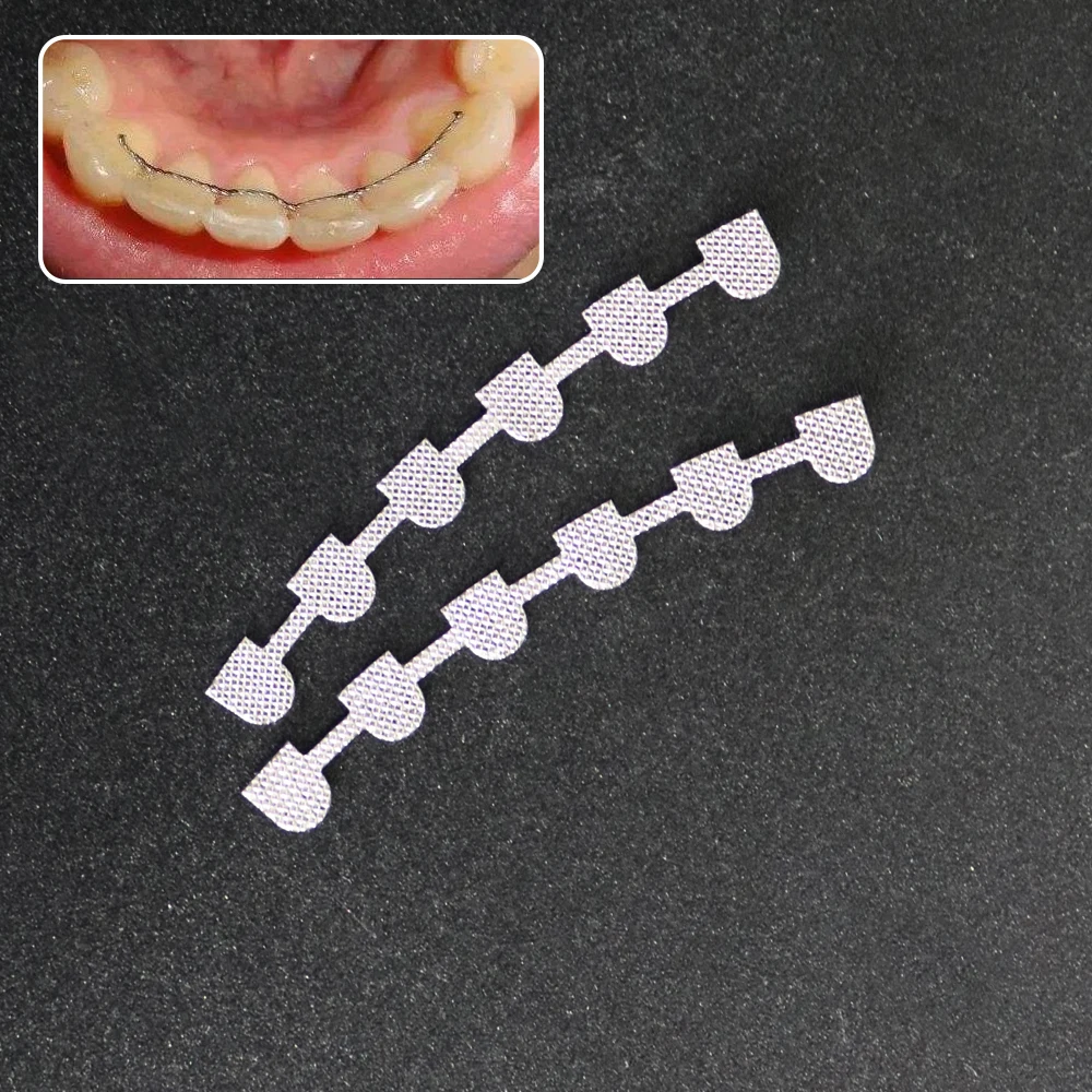 2 Stks/pak Orthodontische Mesh Roestvrijstalen Houder