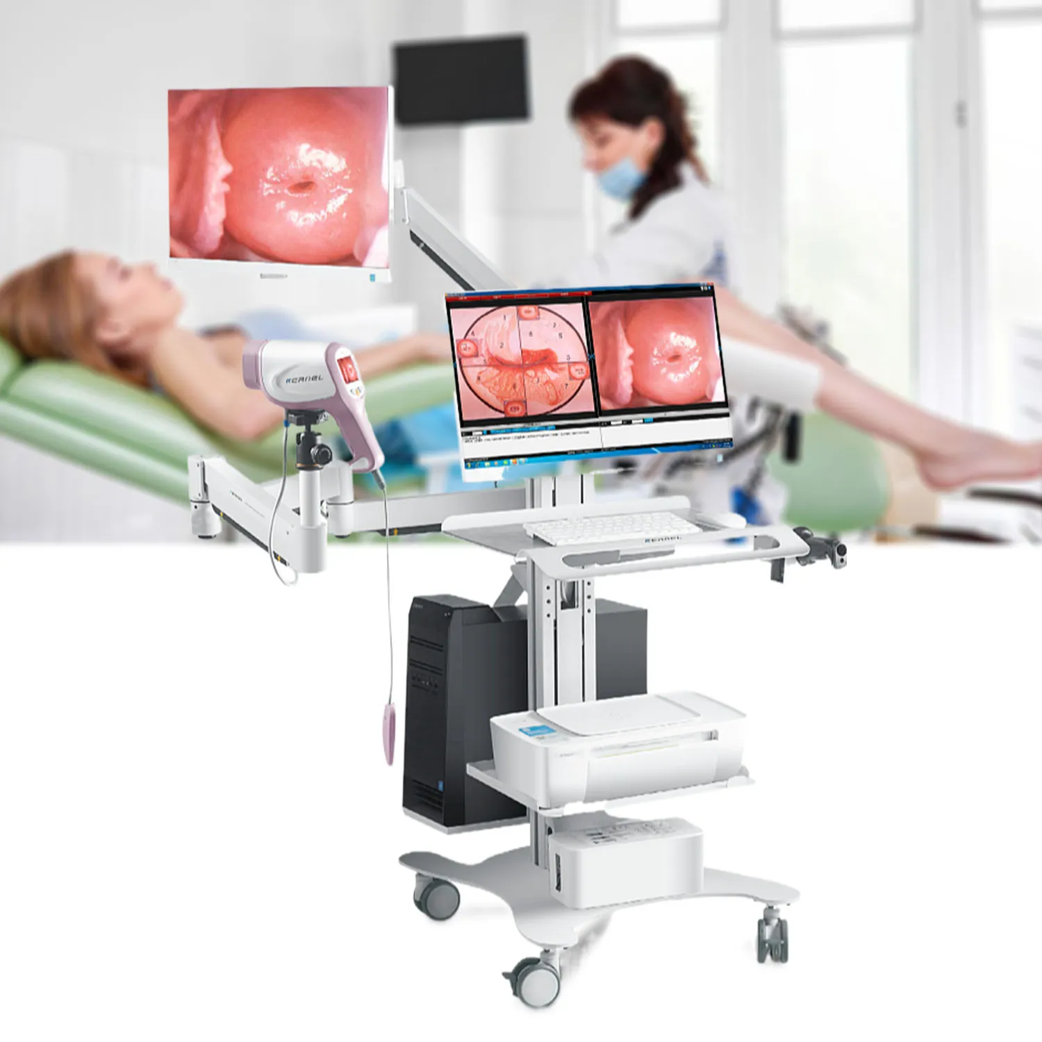 2026 Hot Selling Kernel KN2200I HD CCD Digital Video Kernel Optic for Gynecology Colposcopy with Software