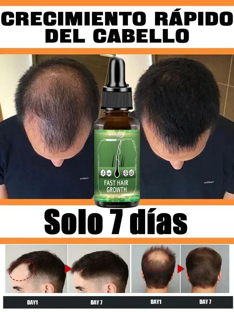 Get more hair, say goodbye to baldness and thick hair.