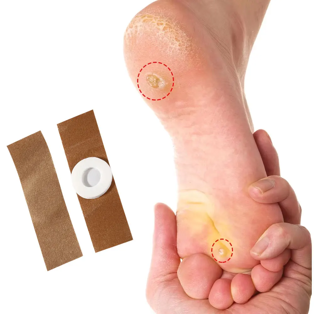 Foot Corn And Callus Removal Clavus Paste DIY Plaster Fixing Patch Blank Stickers Acupoint Patch for Foot Care