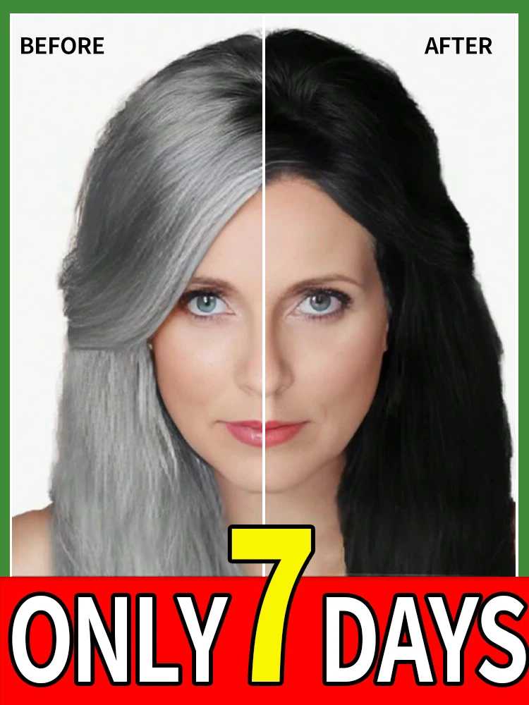 

Anti-Gray Hair Treatment - Restore Your Original Color!