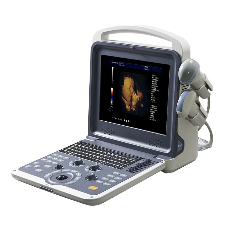 Medical portable 4d full digital color doppler b ultrasound scanner machine