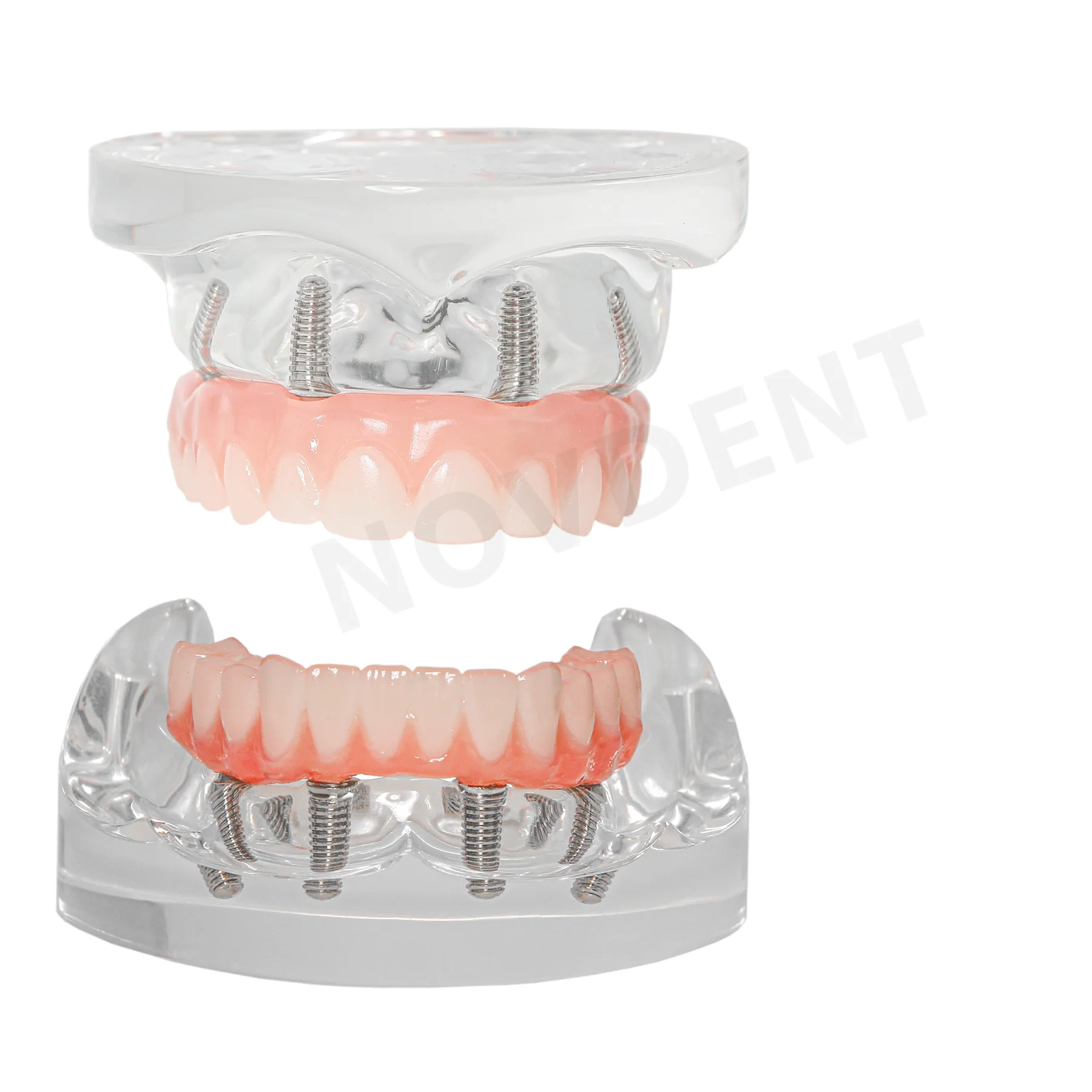 Dental Upper/Lower 4 Implants Demo Implant Teeth Study Model Restoration Overdenture