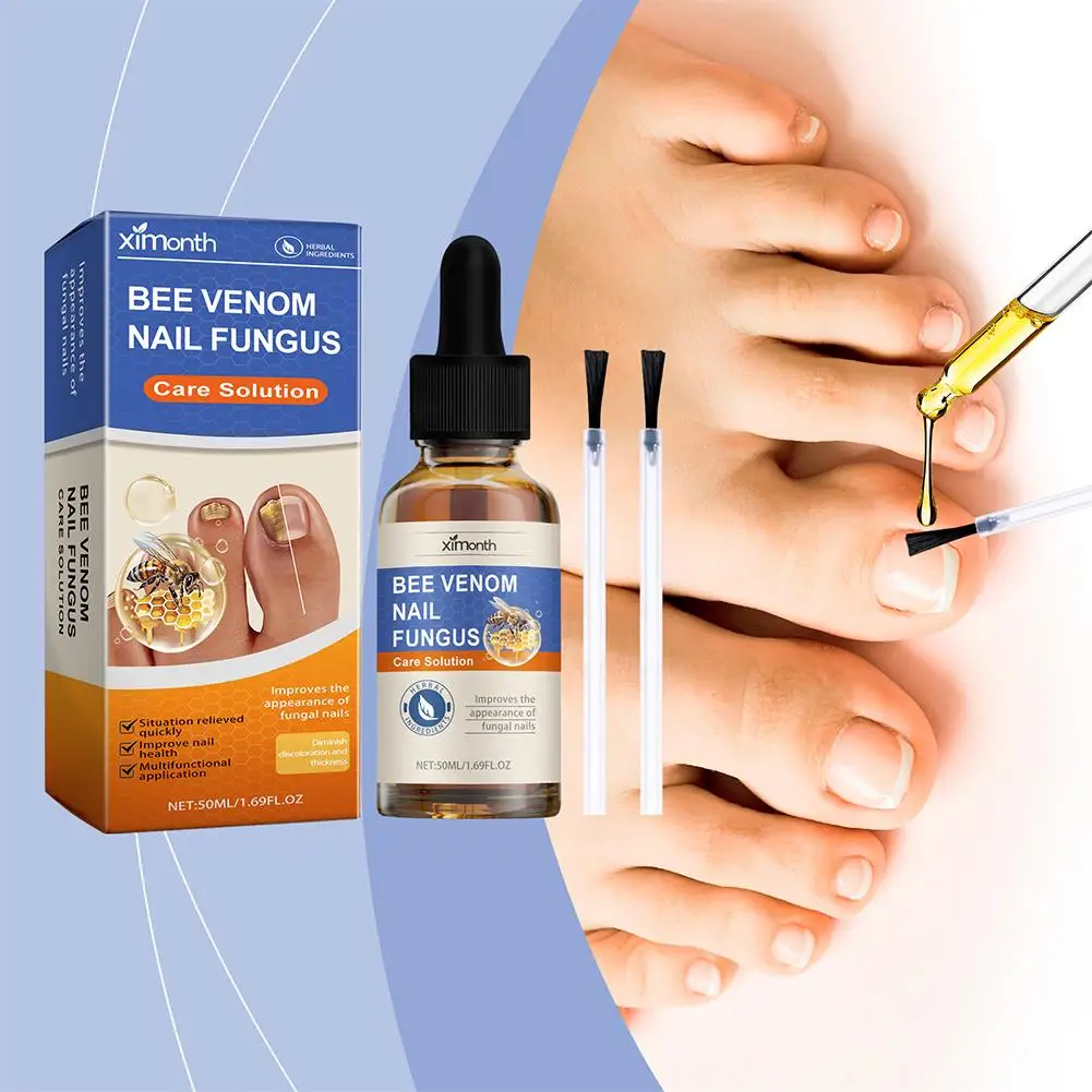 Nail Fungal Treatment Essential Oil Foot Toe Nail Fungus Removal Serum 7 Days Repair Onychomycosi Anti Infection Care Products