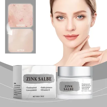 여드름 크림 컨트롤 오일 페이드 여드름 자국, 부드럽게 진정, 입 막힘 제거, 민감한 근육용 여드름 회복