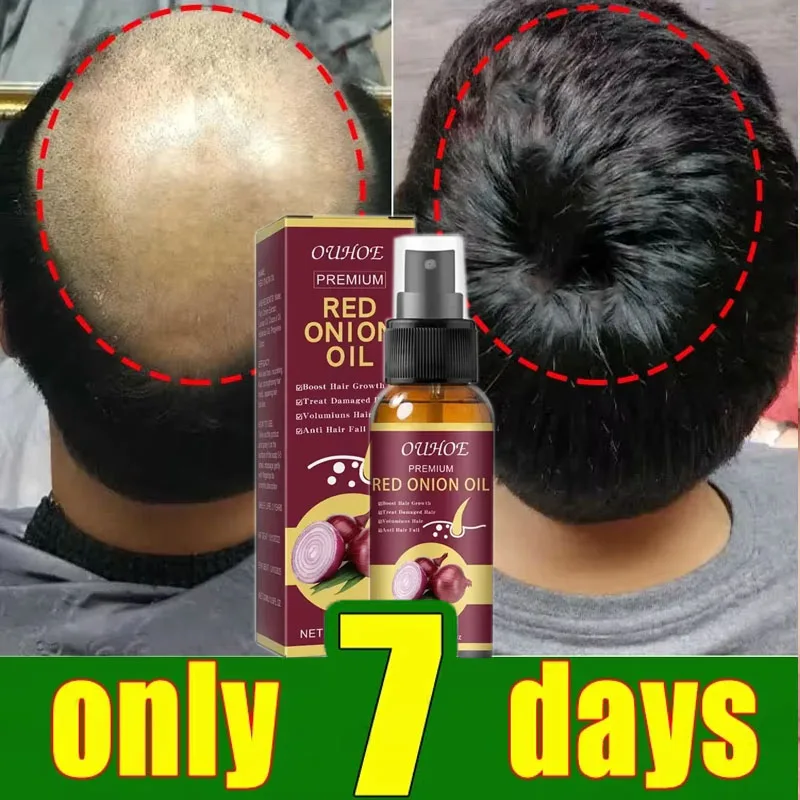 

Powerful Hair Growth Serum Spray Anti Hair Loss Treatment Regrowth Hair Essence Repair Hair Nourish Root For Men Women Hair Care