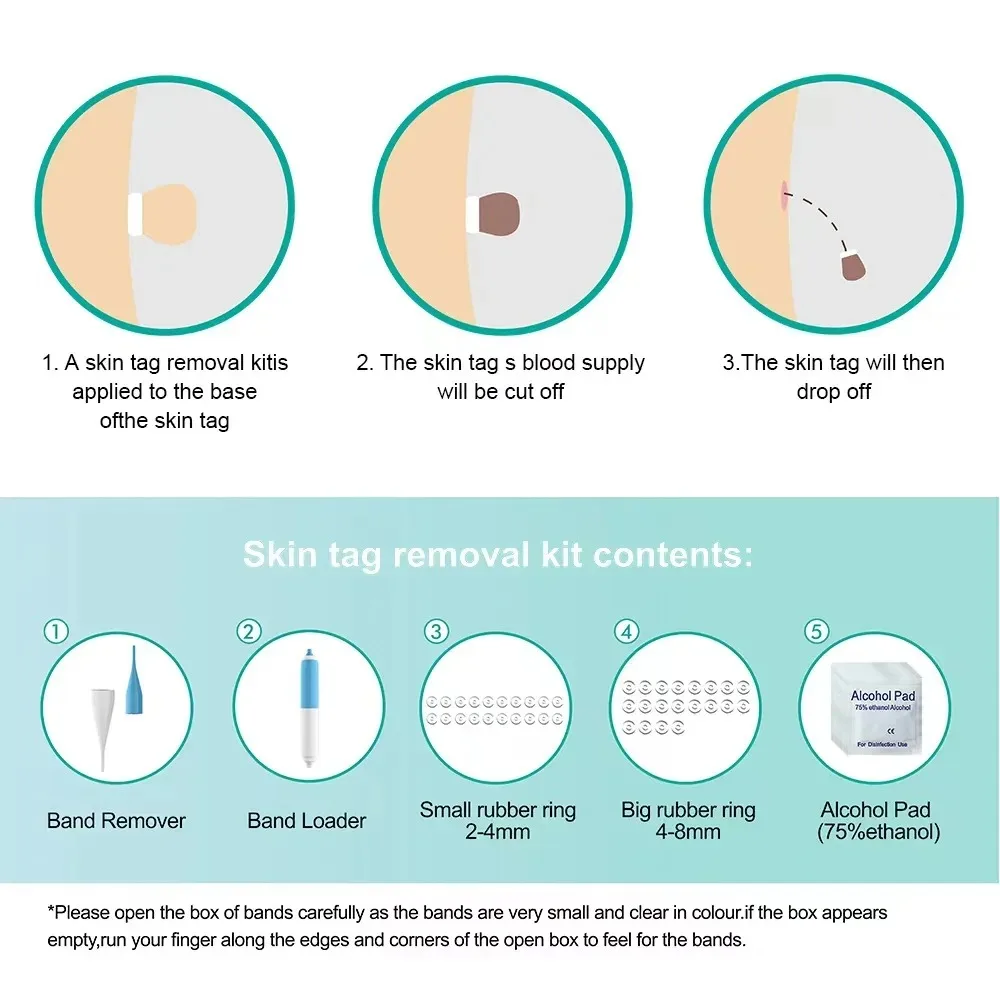 Gereedschap voor het verwijderen van huidtags Rubberen ringen Gezicht Schoonheidsaccessoires Apparaat voor het verwijderen van huidtags Multifunctionele benodigdheden voor gezicht, nek, kin, rug