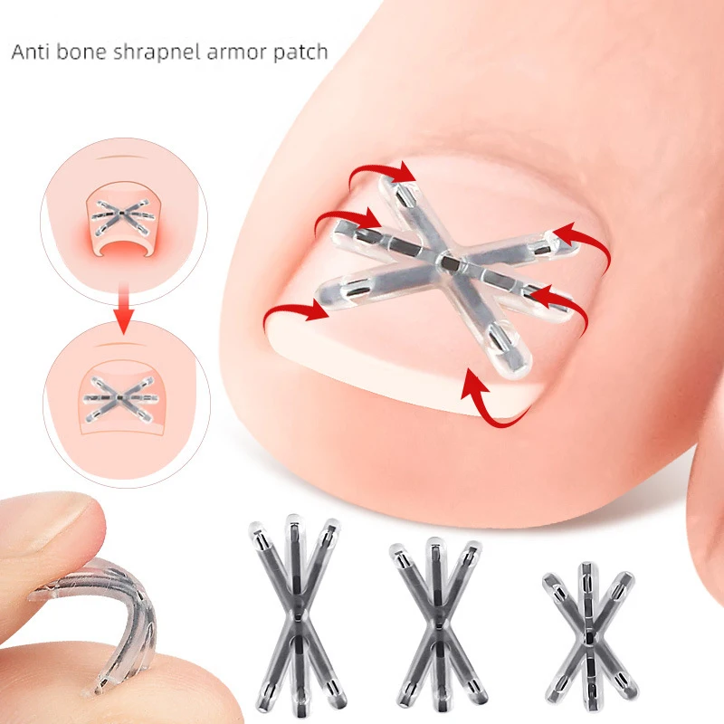 2 Pcs Ingrown Toenail Correction Tool Set with Elastic Patch Sticker Pedicure Tools for Toenail Straightening And Treatment