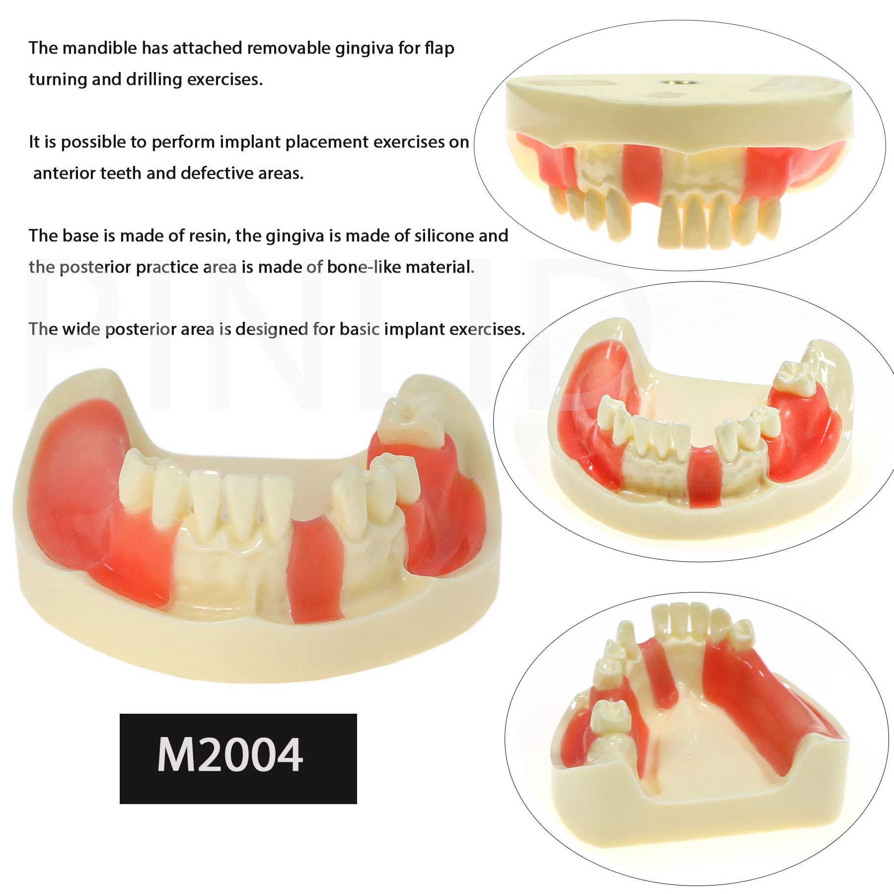 Modèle de pratique d'implant dentaire, dents de la mâchoire inférieure, perfecgingiva, domination du fuchsia et de la recherche, M2004