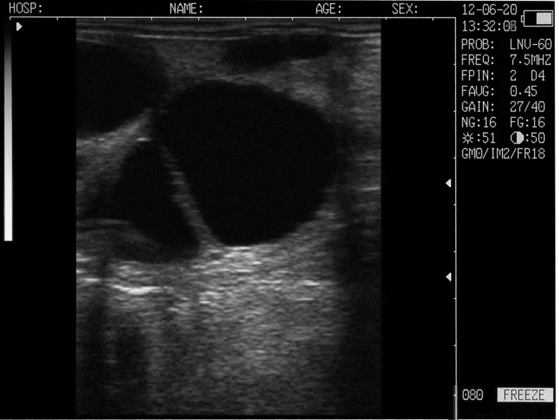 Low price portable handheld veterinary ultrasound machine for cow and horse support different probes