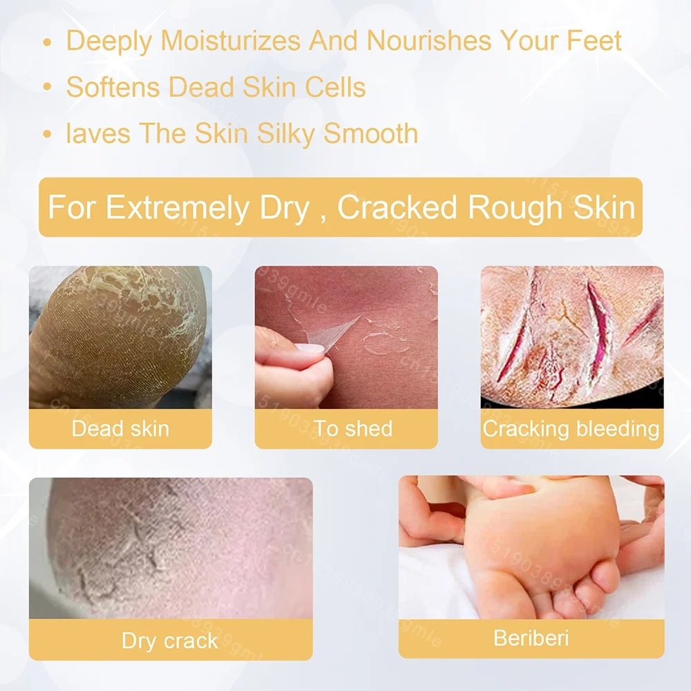 Foot Exfoliating Repair Brightening Spray Anti-Drying Crack Peeling Treatment Removal Dead Skin Calluses Feet Nursing Tools