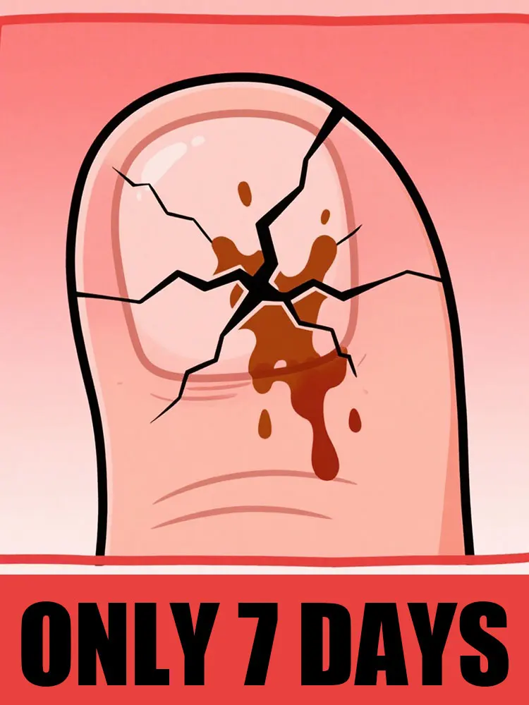 Nail set, plastic storage box, goodbye nail trouble