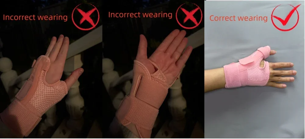 Flexible Handgelenk-Daumen-Stützorthese für Sehnenentzündung und Arthritis, atmungsaktiver Daumenschutz, passend für rechte und linke Hand – Detail 1