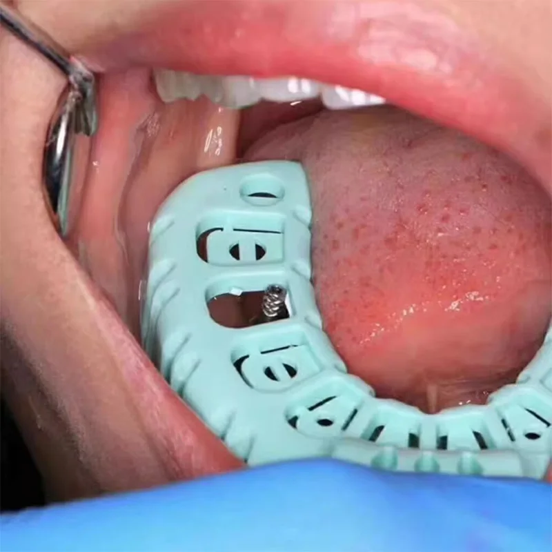 6 قطعة صينية انطباع الأسنان البلاستيكية يمكن التخلص منها صواني الأسنان حامل الأسنان أداة فني طبيب الأسنان #6