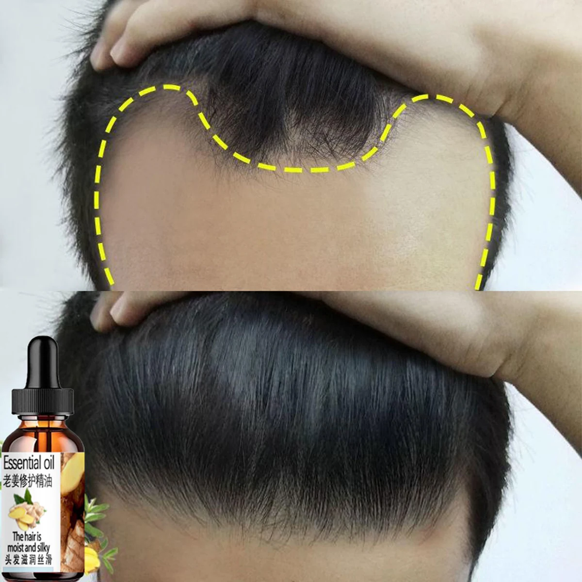 Hair Growth Products Ginger Fast Growing Hair Essential Oil Beauty Hair Care Prevent Hair Loss Oil Scalp Treatment For Men Women