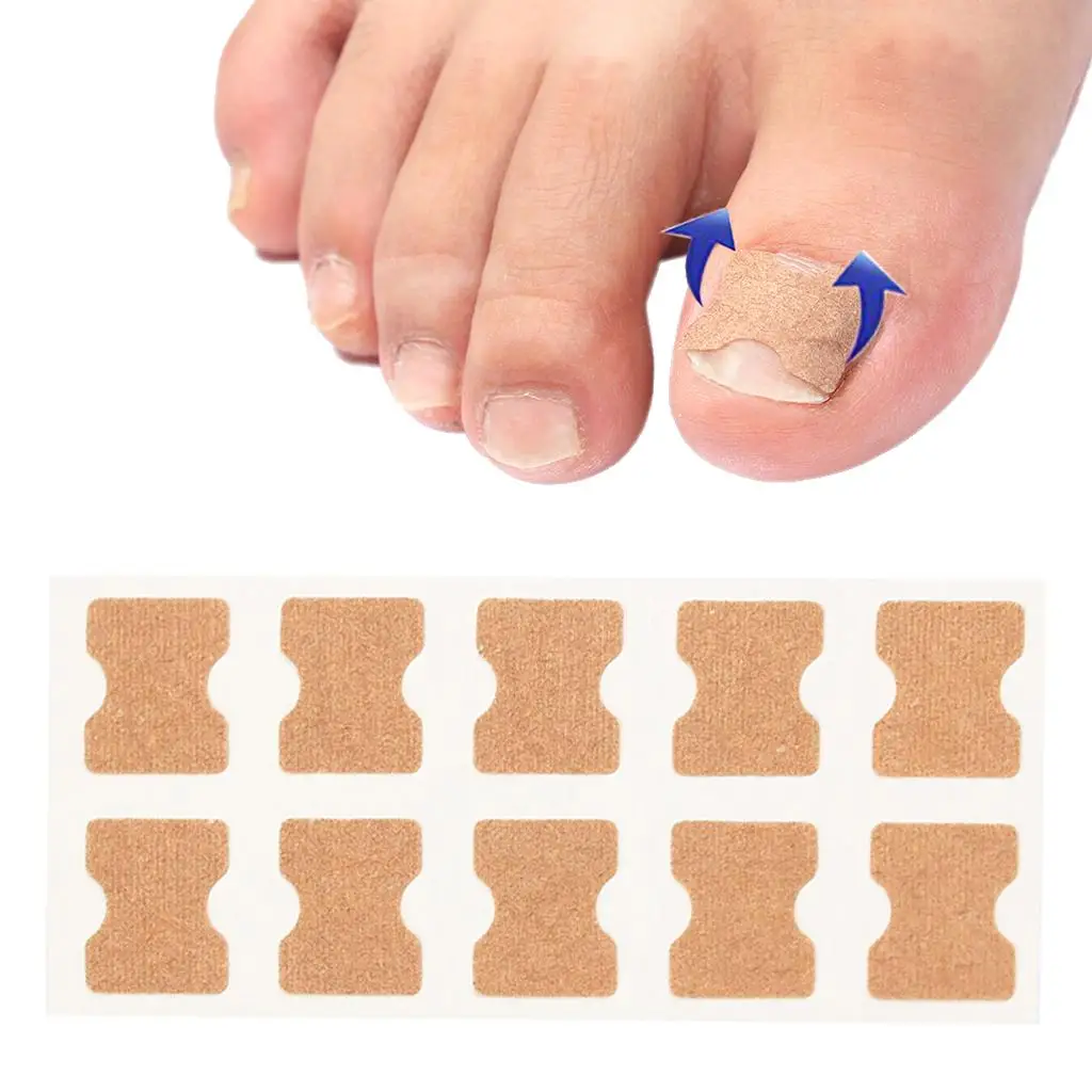 Pegatinas correctoras de uñas de los pies, herramientas correctoras elásticas para uñas de los pies, corrección