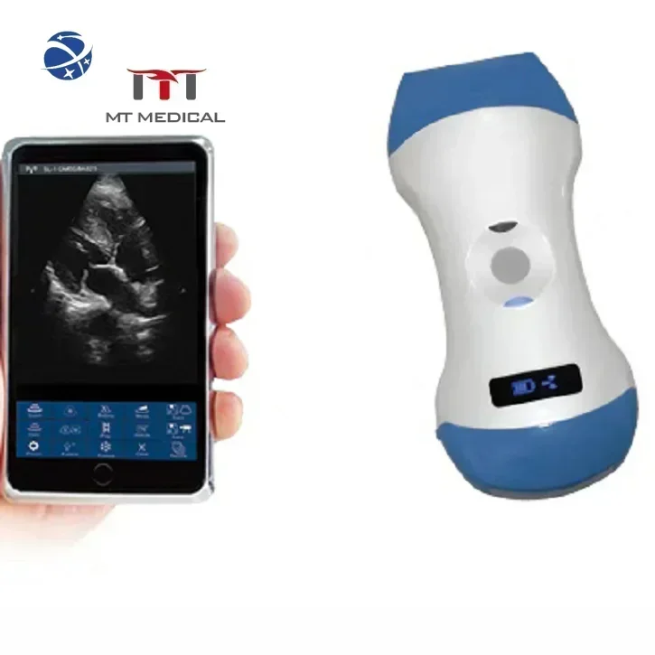 Original brand newMT MED·ICAL 3 IN 1 color dop·pler 128 elements wireless ultrasound portable scanner machine price