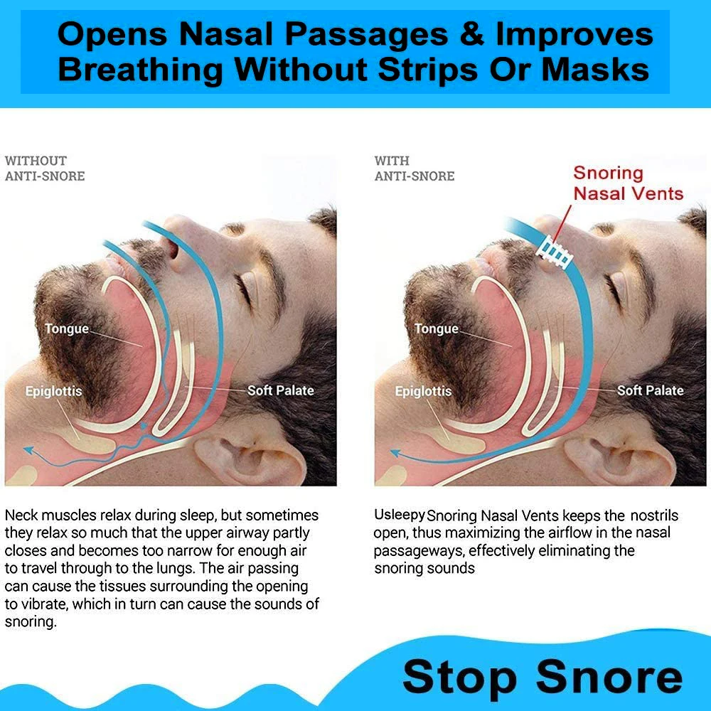 4/8PCS Anti Snoring Device Nose Clip Hollowed/silicone Snoring Snore Apnea Solution Stop Insonia Sleeping Men Women anti Ronco