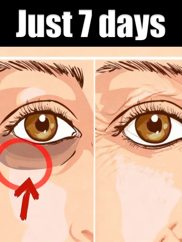 

Facial care tools to relieve fatigue and reduce eyelid fat