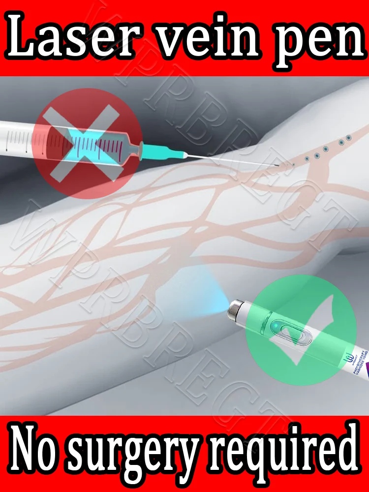 

Laser vein pen