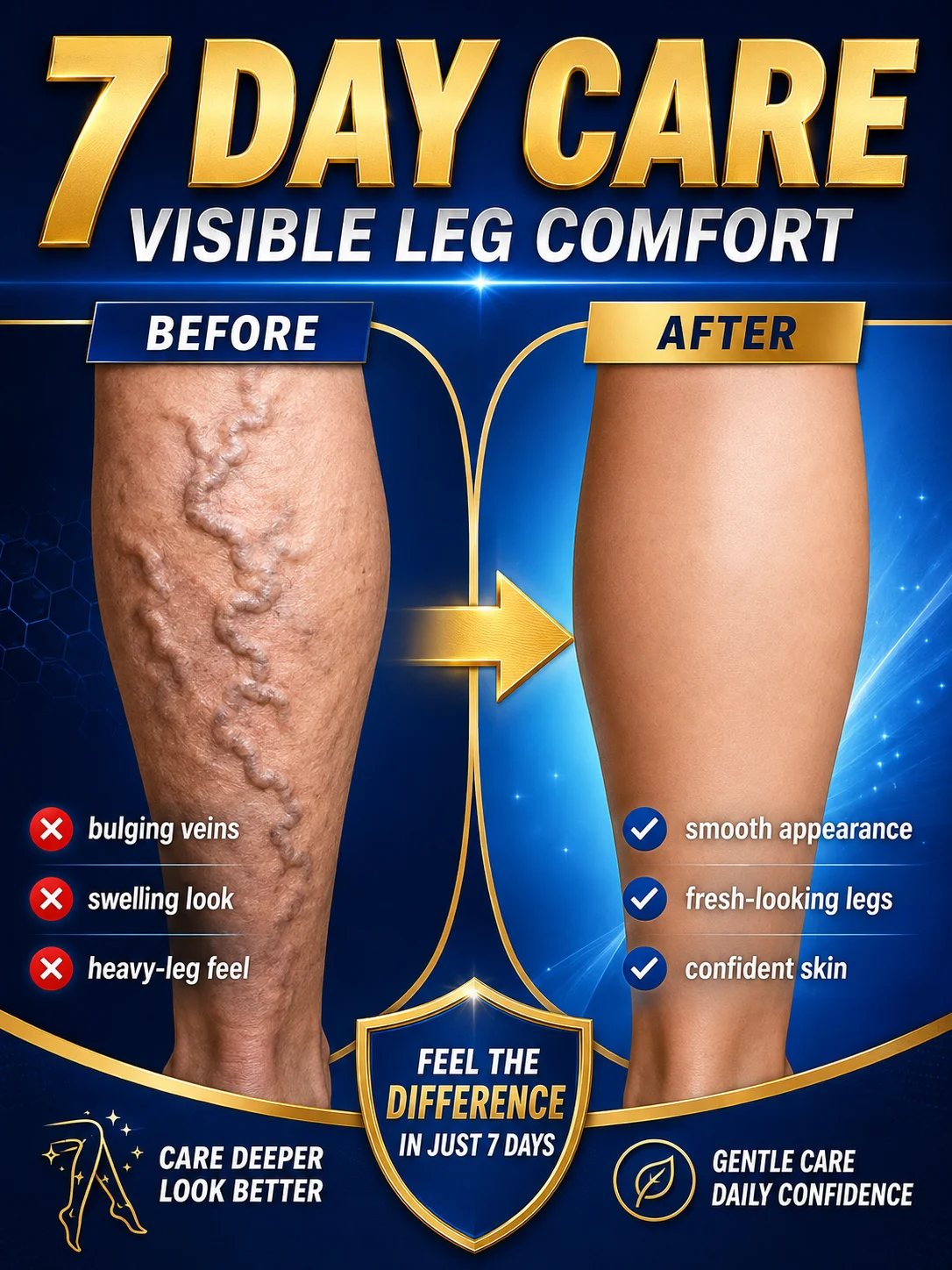 Advanced Blue Light Pen Laser Technology Device for Veins on Legs