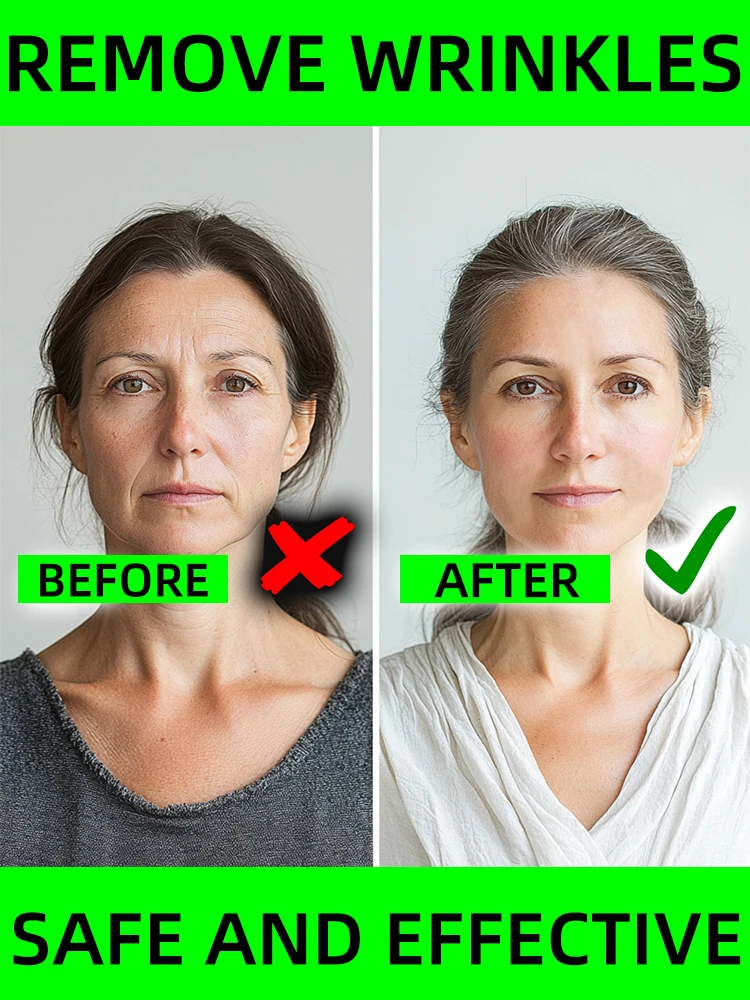 

Solve all facial wrinkle problems