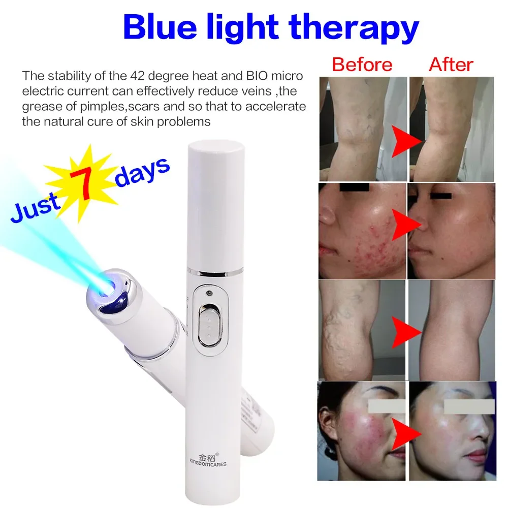 Blu-Ray Anti-Acne theraphy Pen Remove Dark Circles Under Eyes Anti Wrinkle Portable Laser Pen Facial Beauty Skin Care Tools