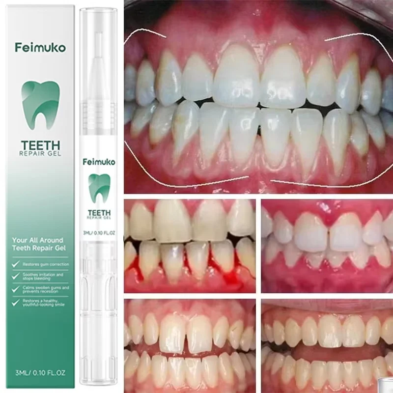 Damaged Gum Repair Care Gel Relieve Sore Gums Allergy Deep Cleaning Teeth Stains Tartar Serum Dental Caries Toothpaste