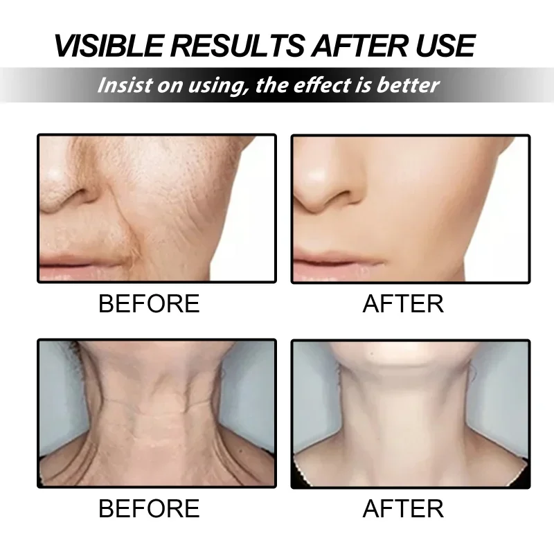 المضادة للتجاعيد الرقبة كريم شد الوجه ثبات مكافحة الشيخوخة تبييض ترطيب مصل تفتيح الرقبة غرامة خط منتج العناية بالبشرة
