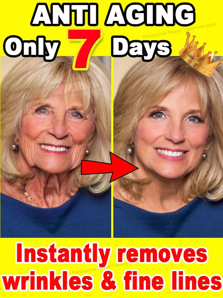 Wrinkles disappear Become beautiful now