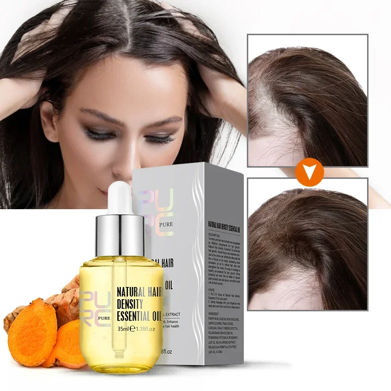 Hair Growth Serum Ginger Extract Prevent Hair Loss Oil Scalp Treatments Fast Growing Hair Care for