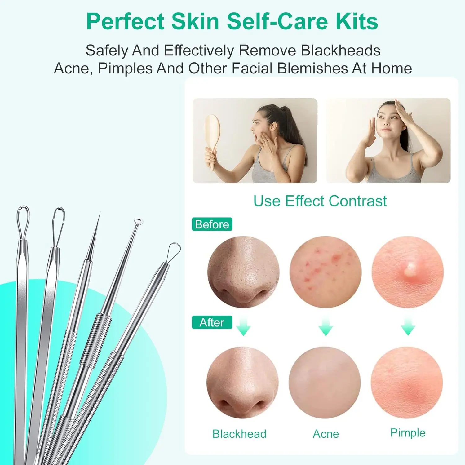 5PCS Stainless Blackhead Removers Pimple Popper Tool Kit Blackhead Extractor for Face Comedone Zit Acne Whitehead Blemish