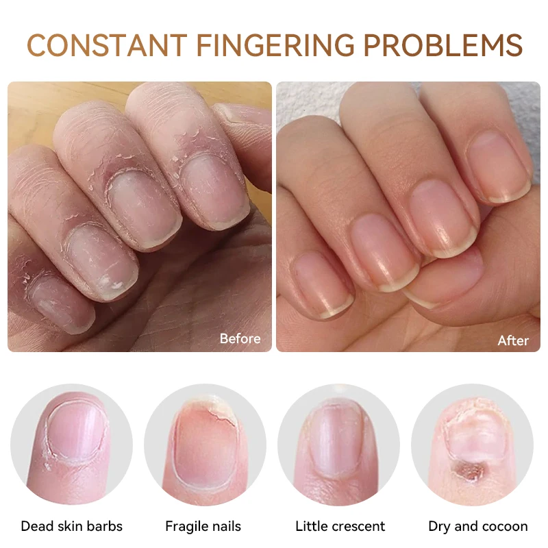 LILYCUTE 5 مللي بشرة الأظافر المغذيات النفط استعادة الأظافر التالفة المنقي علاج مغذي الجلد تنشيط علاج مانيكير #4