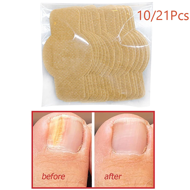 Parches para reparación de uñas, parche para hongos en las uñas de los pies, cuidado de las uñas de los pies pegajosas, pegatina de corrección encarnada, parche para tratamiento de paroniquia, 10/21 Uds.