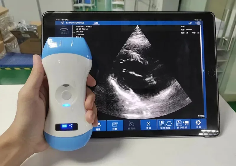 3 in 1 Wireless Cardiac Ultrasound Scanner Machine Convex / Linear Phased Array probe