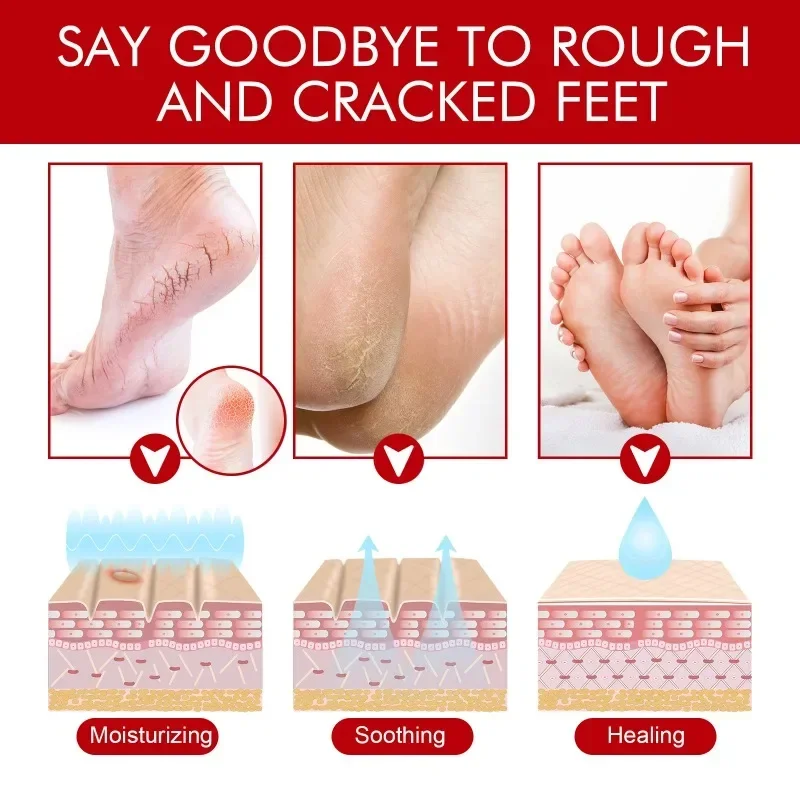 Sdotter New Heel repair cream anti-dry Crack peeling heels chapped hydrating moisturizing remove Callus Dead skin exfoliation ha