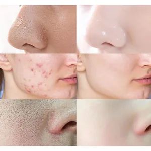 9 en çok satılan ürünler, hidroklorik asit-no. 4